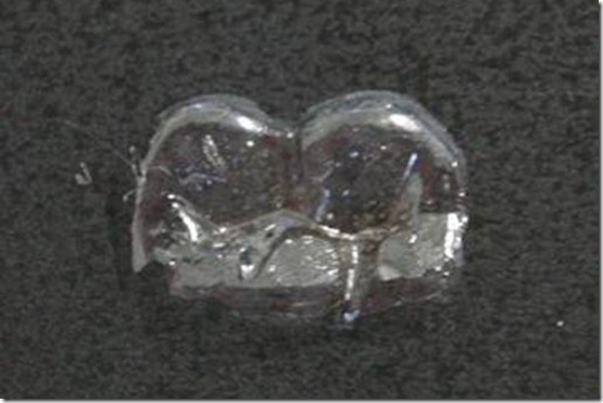 revestimento-dental
