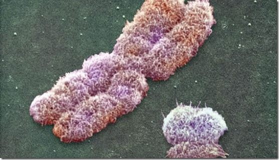 Human sex-determining chromosomes: X chromosome (left) and the much smaller Y chromosome.